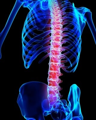Spinal Inflammation Arthritis - Newcastle Research Institute - Genesis Research Services