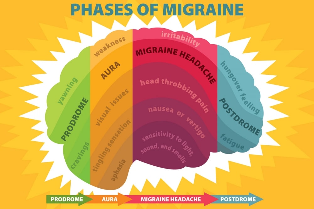 Migraine Phases - Newcastle Research Institute - Genesis Research Services