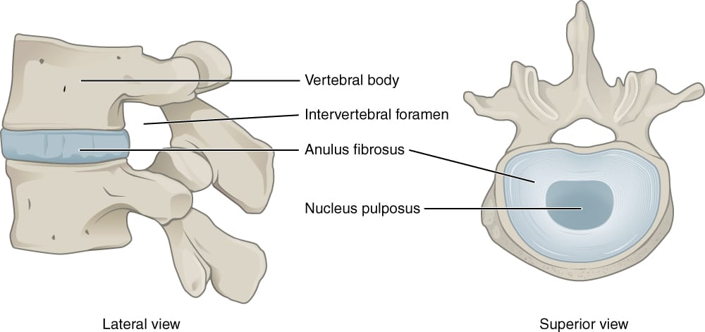 Intervertebral disc spinal - Newcastle Research Institute - Genesis Research Services