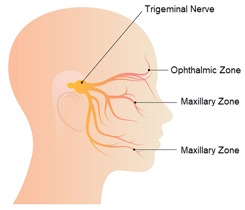 An illustration of the side view of the head that shows the trigeminal nerve and its branches, which can be stimulated for migraine relief
