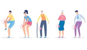 People with painful knees, representing symptoms of knee osteoarthritis.